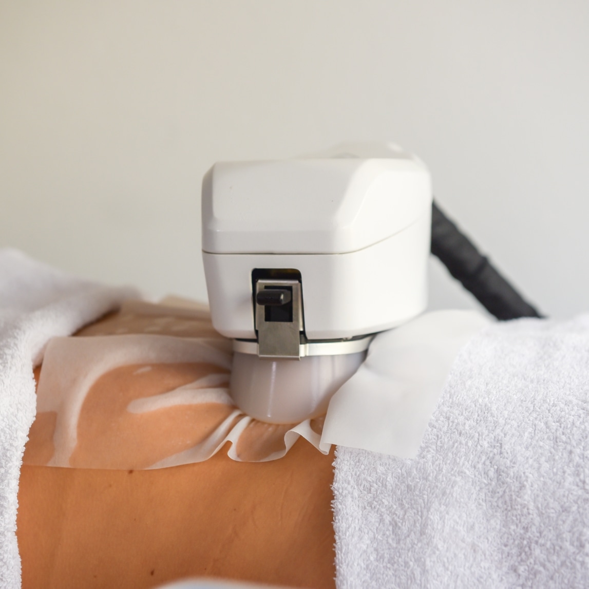Tratamiento estético facial en Azzara Estética Paraná