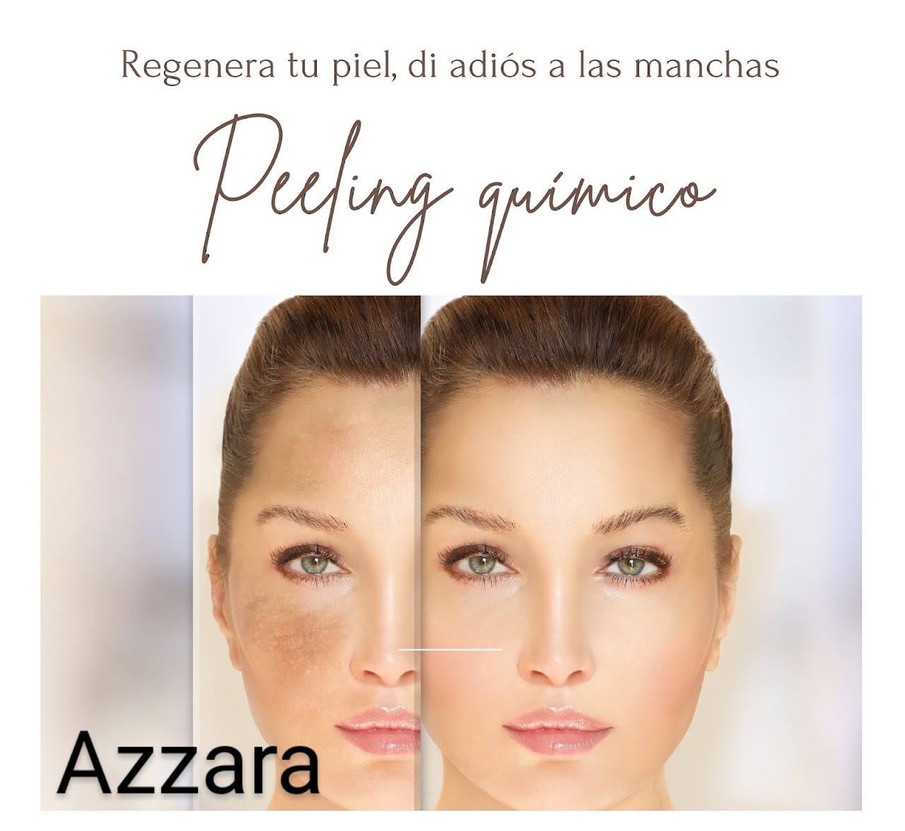 Depilación láser en Azzara Paraná